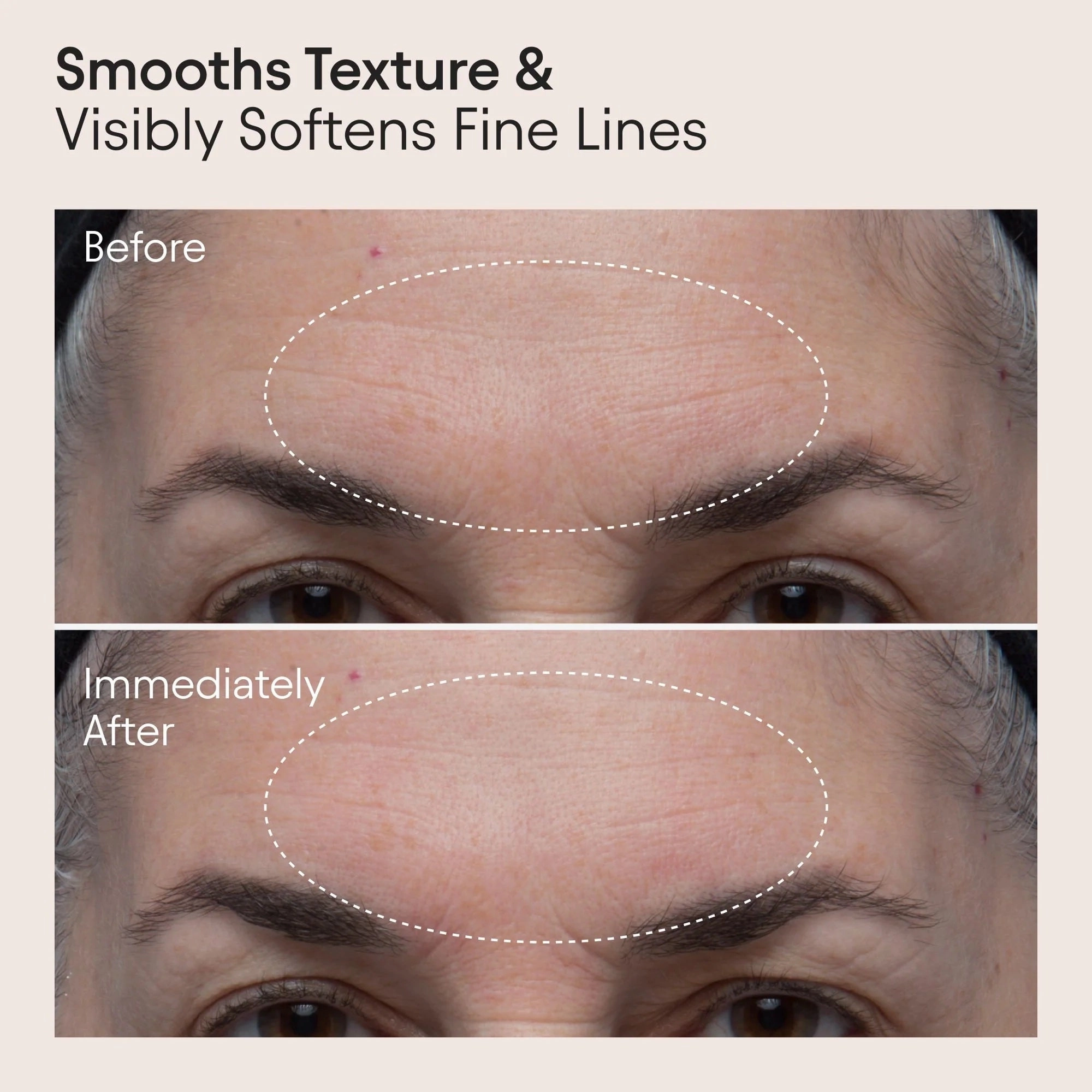 8 Acid Double Polishing Peel