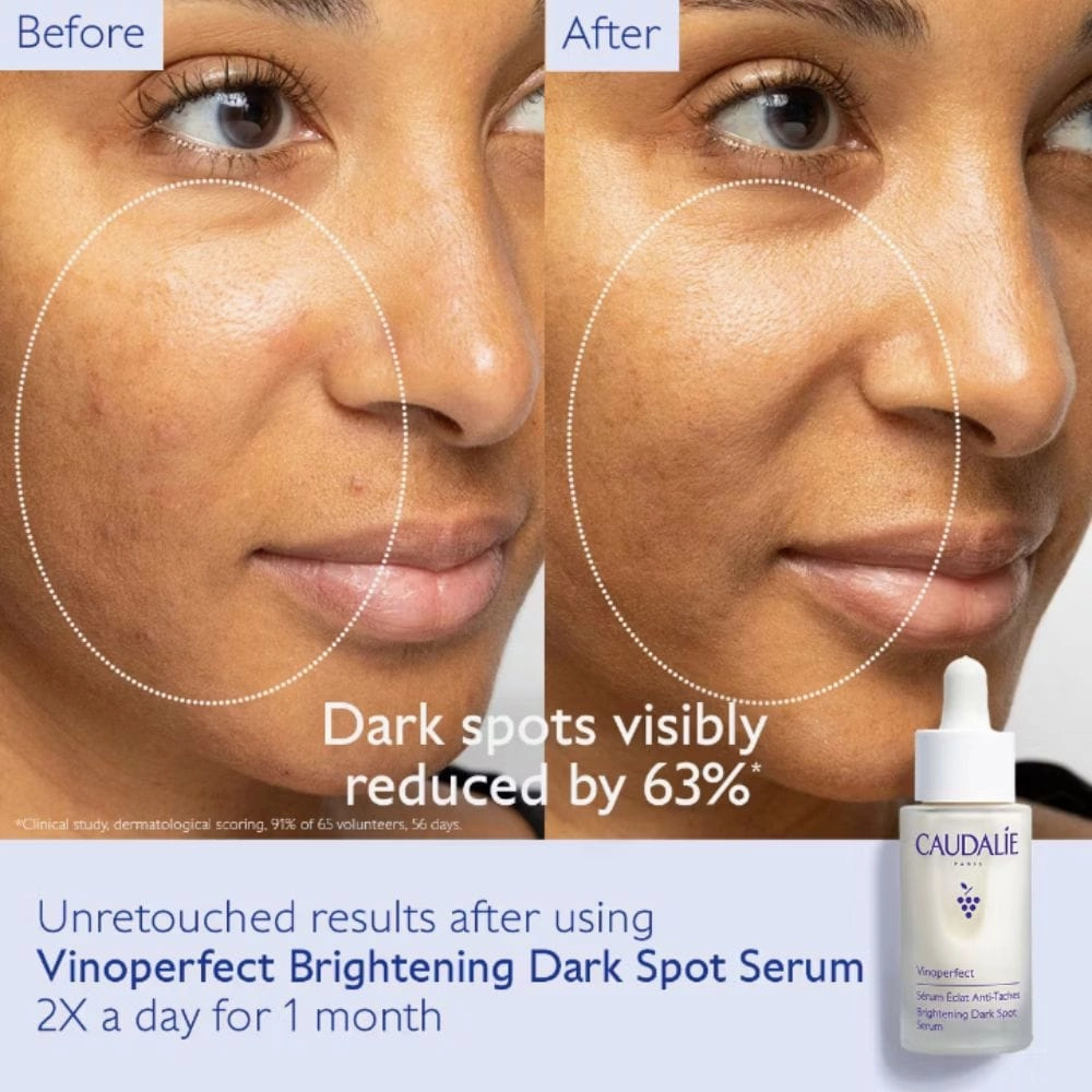 Caudalie Vinoperfect Brightening Dark Spot Serum