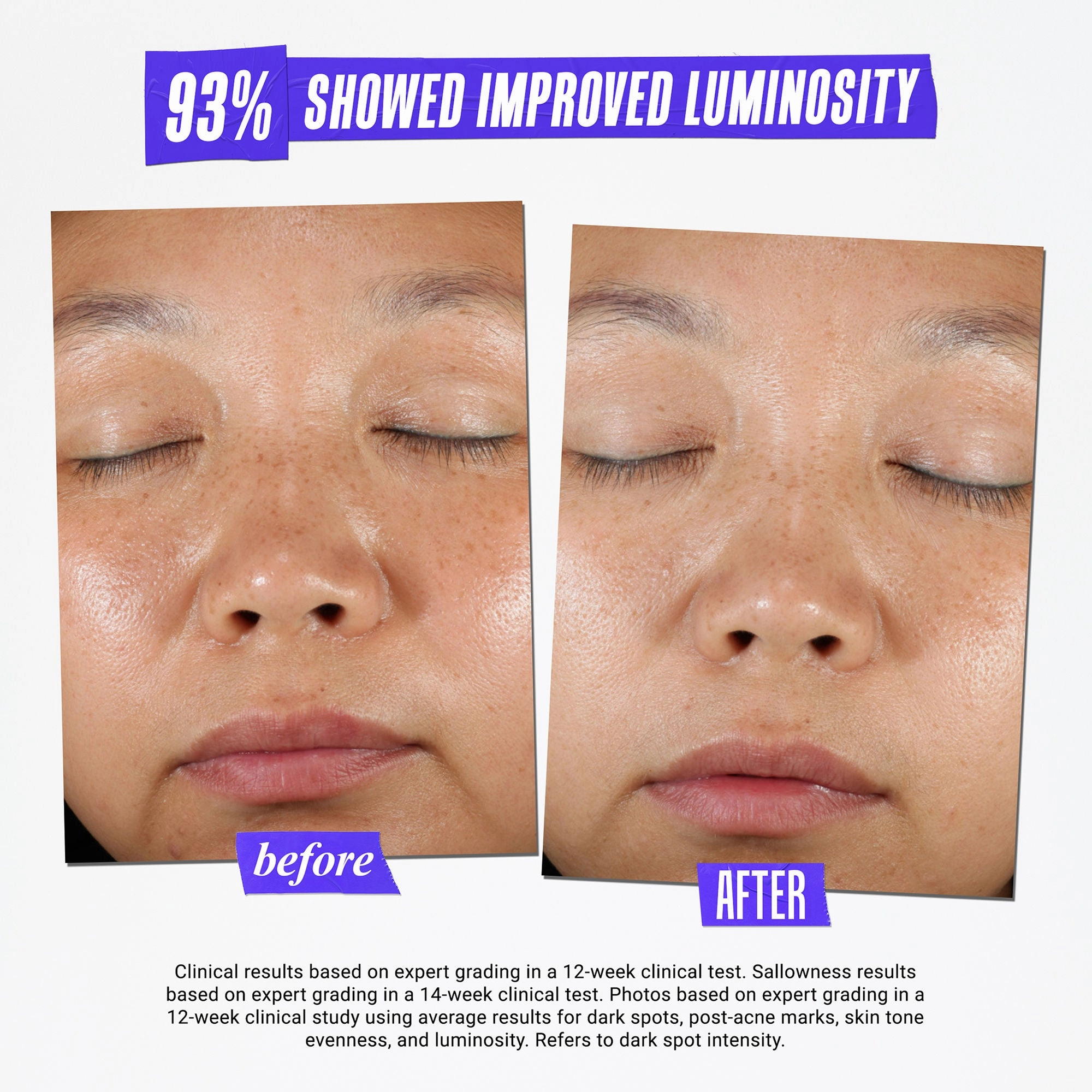 Clearly Corrective Dark Spot Solution