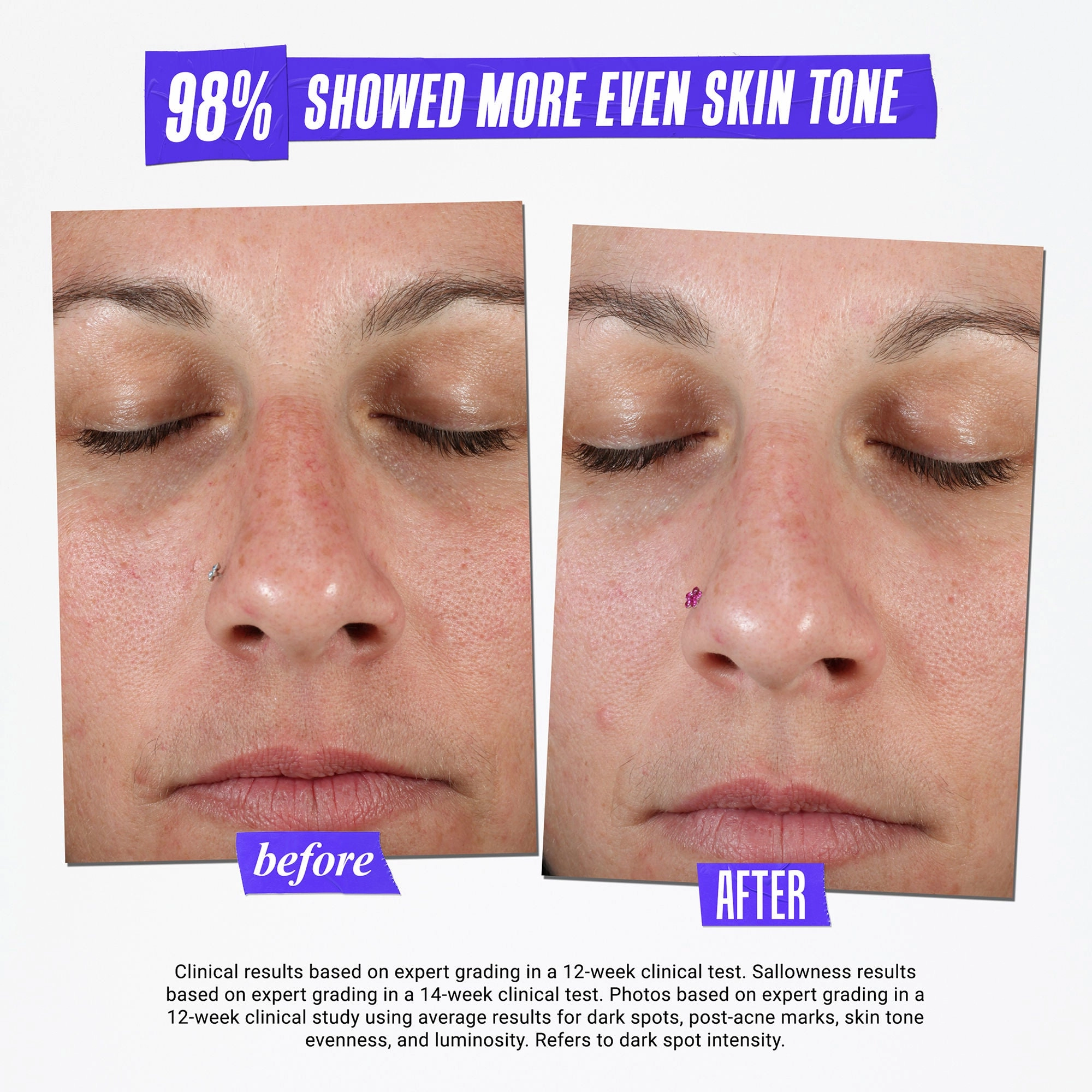 Clearly Corrective Dark Spot Solution