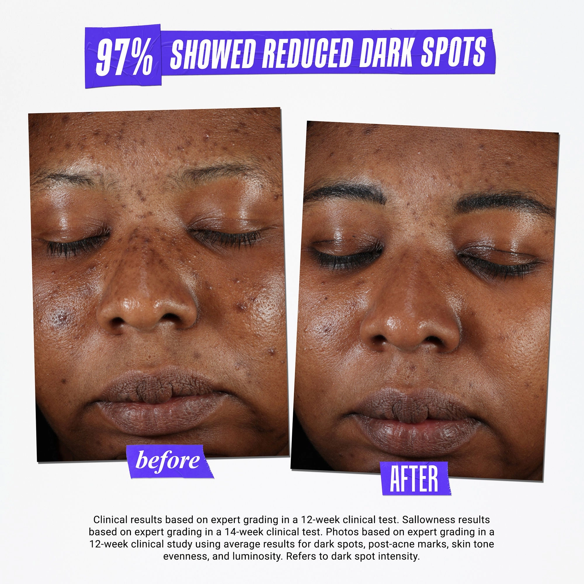 Clearly Corrective Dark Spot Solution