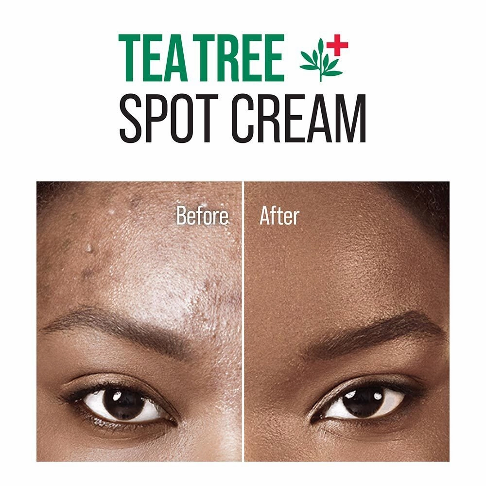 Kiss New York Tea Tree Spot Cream - .94 oz